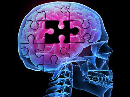 alzheimers-brainpuzzle-512.jpg